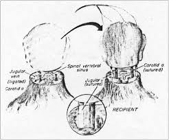 Plastic Surgery? Why Not Just Get a Head Transplant